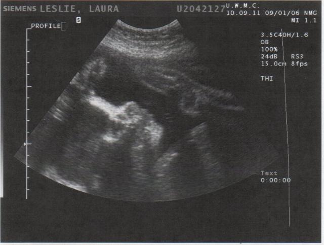bgl_profile1.jpg